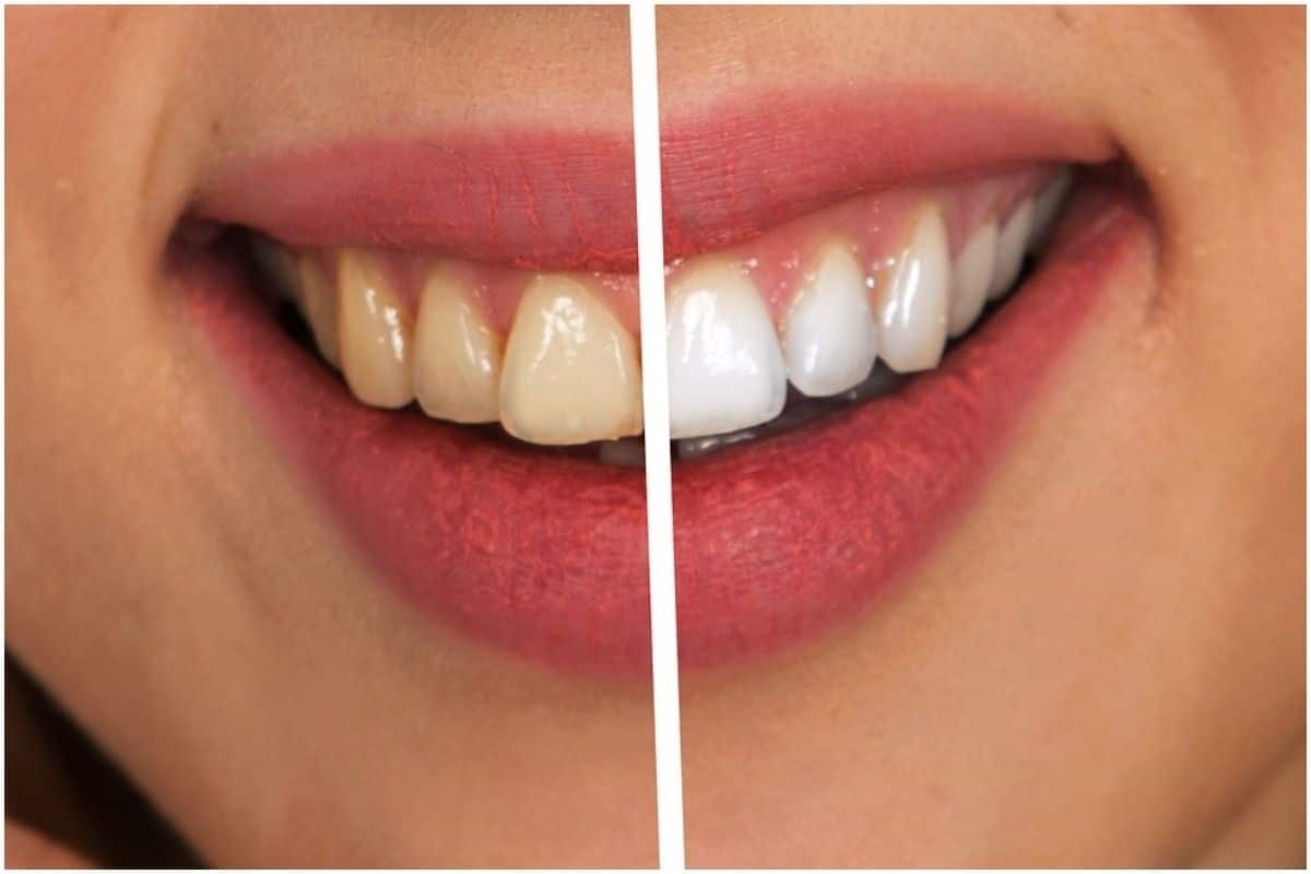 10 phút mỗi ngày để có hàm răng trắng và khỏe mạnh