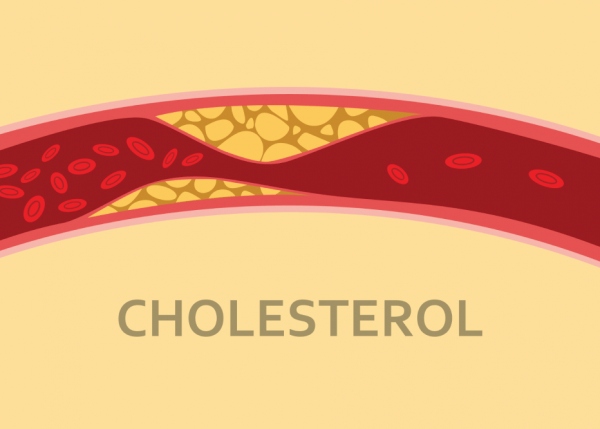 Sự ảnh hưởng của vitamin B đối với tỷ lệ cholesterol HDL