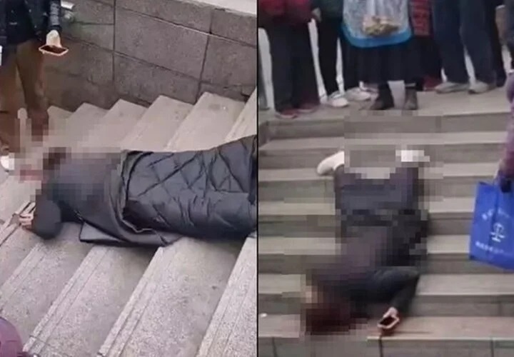 Dùng điện thoại khi xuống cầu thang, cô gái ngã trẻ ngã bất tỉnh