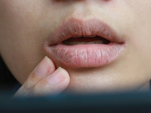 Khô miệng có thể là “báo động đỏ” cho 5 căn bệnh nguy hiểm mà bạn chưa biết