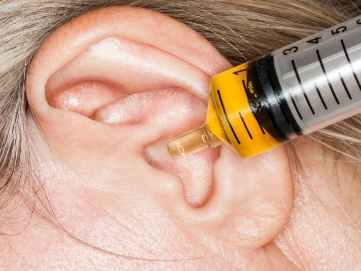 Ngứa tai, chảy dịch- có thể bạn đã bị nấm ống tai ngoài!