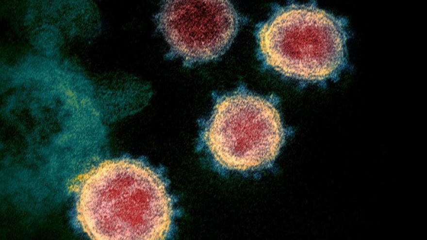 Con người sẽ không thể tự miễn dịch với virus SARS-CoV-2?