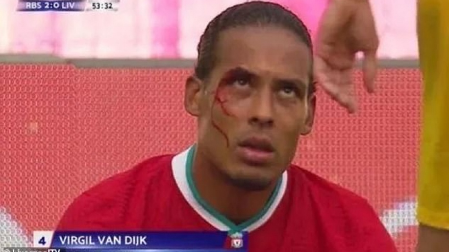 Virgil van Dijk đổ máu ở trận đấu với RB Salzburg