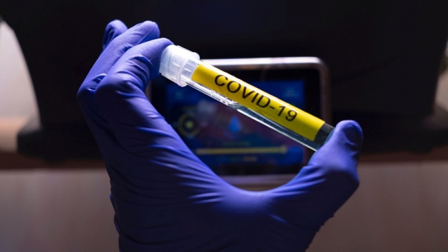 Trung Quốc nói thử nghiệm vaccine Covid-19 của nước này tiến triển thuận lợi