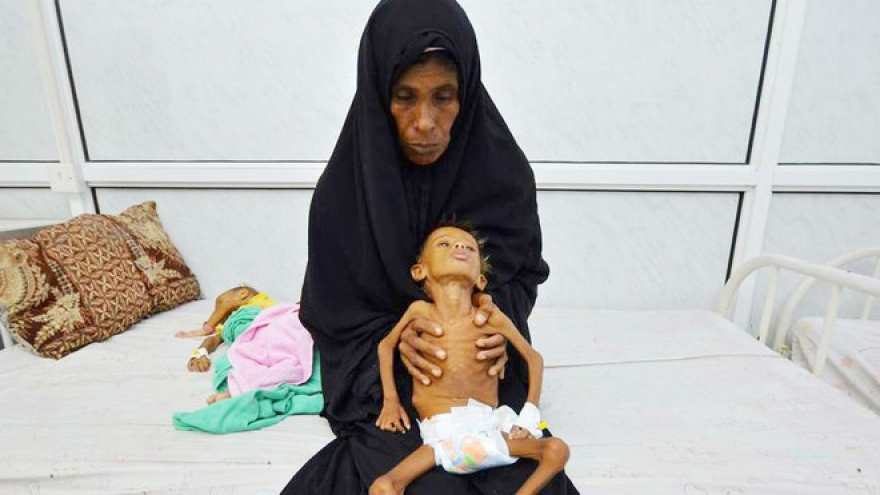 Tổng thư ký LHQ cảnh báo nạn đói tồi tệ nhất thế giới tại Yemen
