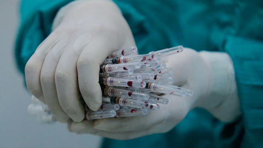 Có bao nhiêu người tham gia thử nghiệm vaccine Covid-19 đầu tiên ở Việt Nam?