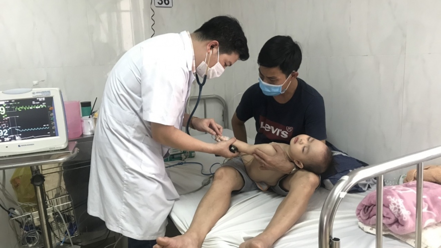 Gia tăng tình trạng trẻ mắc bệnh tay chân miệng độ nặng ở Đắk Lắk
