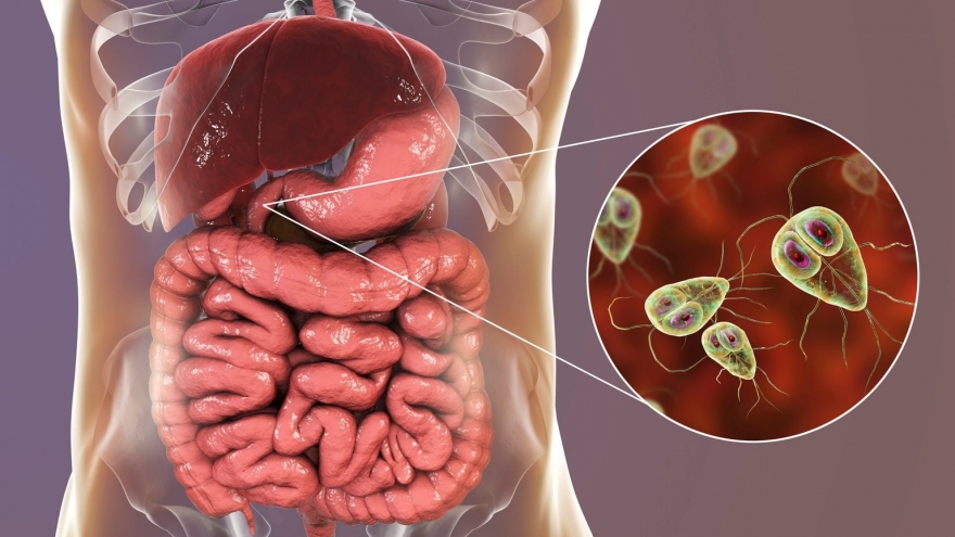 9 dấu hiệu cho thấy cơ thể bạn nhiễm ký sinh trùng