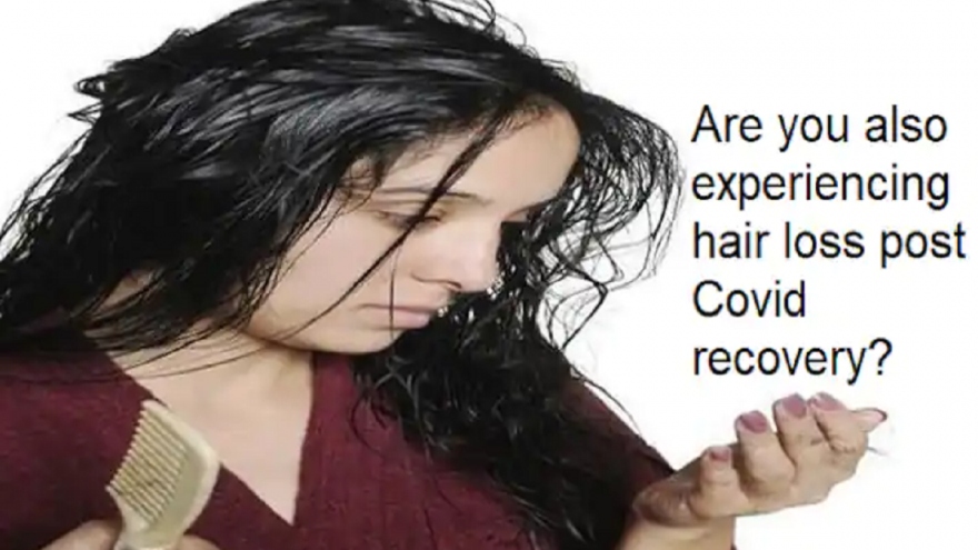 Rụng tóc sau hồi phục COVID-19: Khi nào cần đến can thiệp y tế?