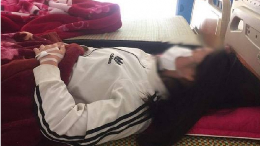 Nữ sinh ở Thanh Hoá bị chủ shop quần áo bạo hành phải nhập viện điều trị