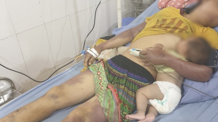 Chồng dùng củi đánh vợ nhập viện ở Sơn La