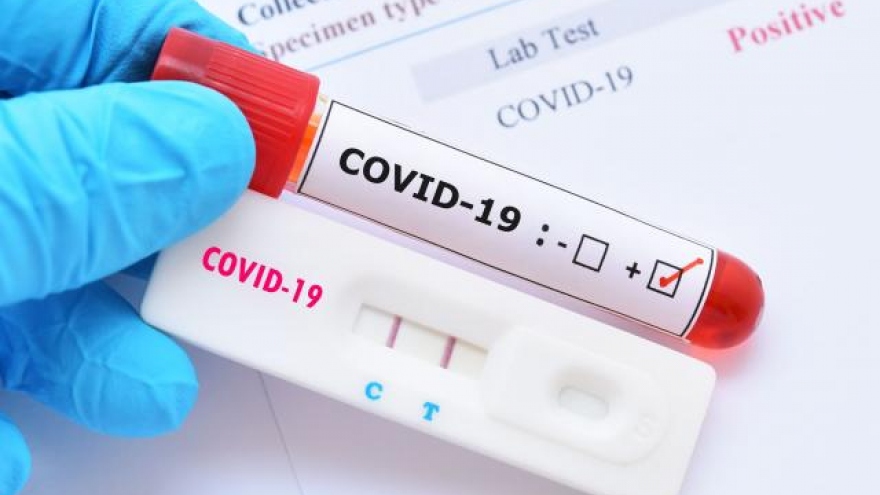 Tái nhiễm Covid-19 có nặng hơn?