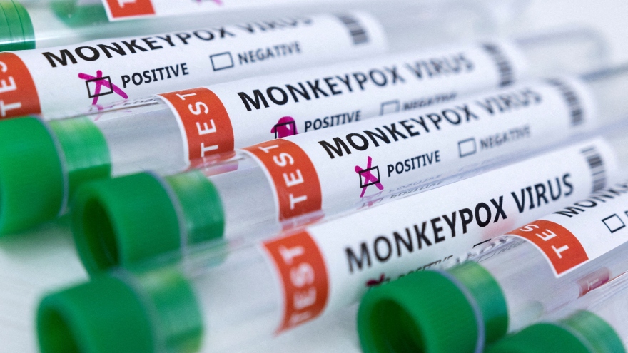 WHO phát hiện virus gây bệnh đậu mùa khỉ trong tinh dịch của bệnh nhân