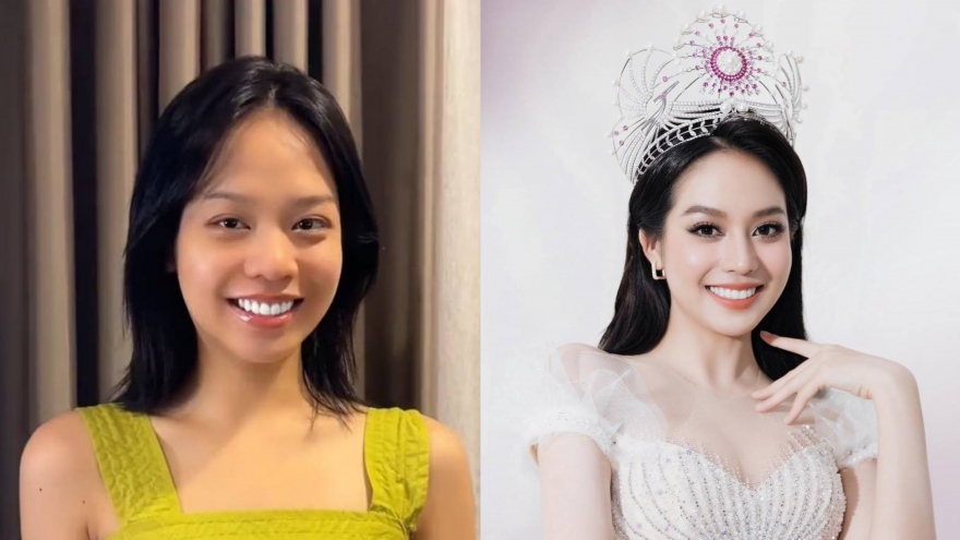 Vừa đăng quang, Hoa hậu Thanh Thuỷ thừa nhận phẫu thuật thẩm mỹ