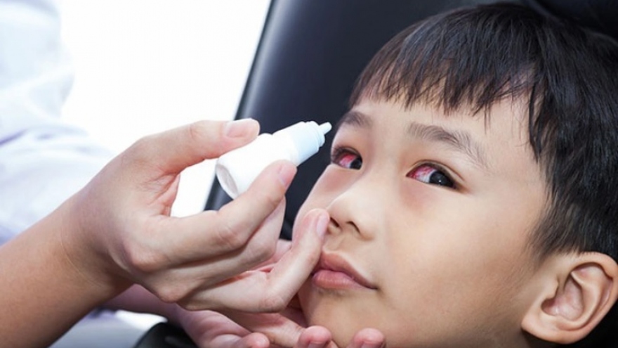 6.000 ca đau mắt đỏ, chủ yếu là trẻ em ở Quảng Bình