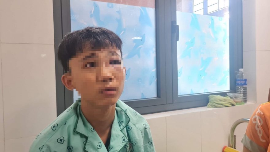 Sở GD&ĐT tỉnh Bình Định thông tin về vụ học sinh lớp 10 bị đánh dập xương mũi