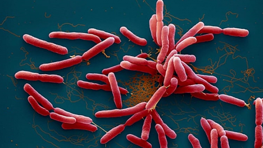 Phát hiện bệnh nhân nhiễm "vi khuẩn ăn thịt người" tại thành phố Buôn Ma Thuột