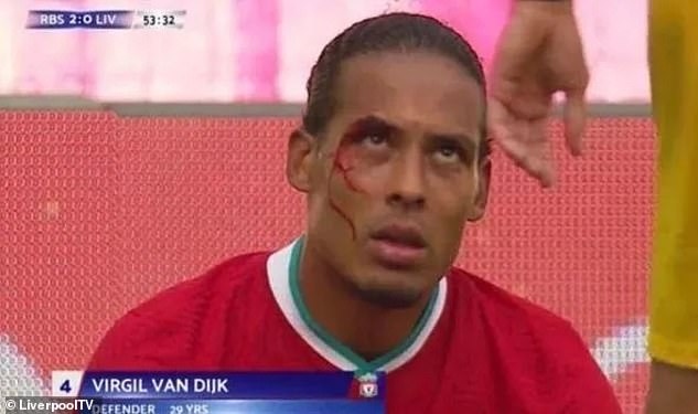 Virgil van Dijk đổ máu ở trận đấu với RB Salzburg