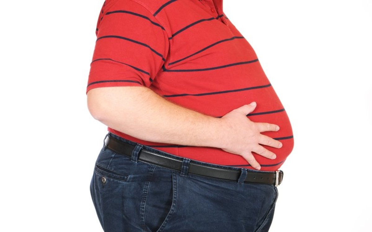 Béo phì là một thuật ngữ dùng để chỉ mức thừa cân nặng từ hơn 20% so với mức cân nặng thông thường xét tỷ lệ với chiều cao.