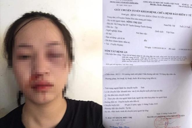 CSGT bị tố vụt gậy vào mặt người phụ nữ đi xe máy: Công an Tuyên Quang lên tiếng