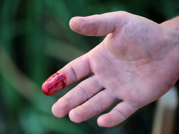 Không dùng vải buộc chặt vết thương đang chảy máu: Dùng vải buộc chặt vết thương đang chảy máu có thể gây áp lực lên mạch máu và dẫn đến máu chảy nhiều hơn. Bạn chỉ nên buộc phần phía trên vết thương do rắn cắn để ngăn độc tố lan ra các phần khác của cơ thể.