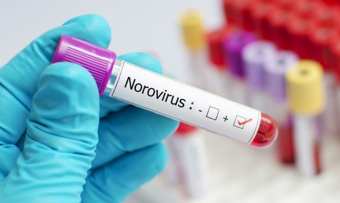 Trung Quốc: Hơn 70 sinh viên nghi nhiễm norovirus