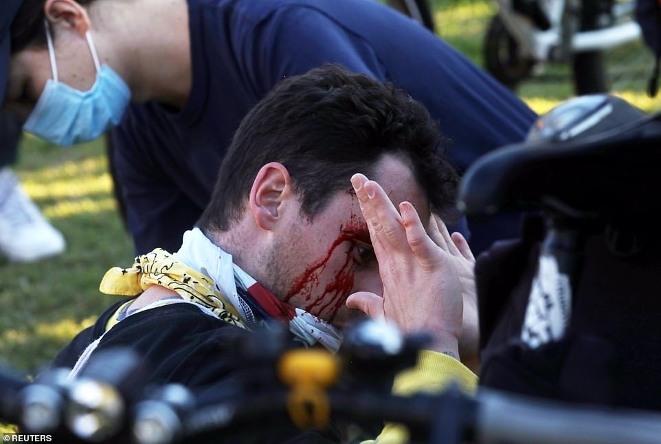 Một người biểu tình bị chảy máu ở mặt trong quá trình xô xát./.