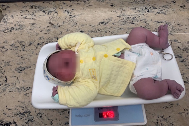 Bé trai chào đời có cân nặng hiếm gặp 5,75 kg