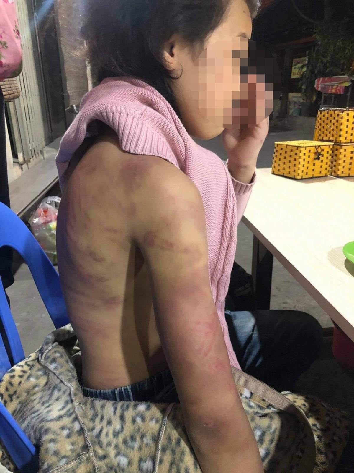 Bé gái 12 tuổi ở Hà Nội bị mẹ đẻ hành hạ dã man