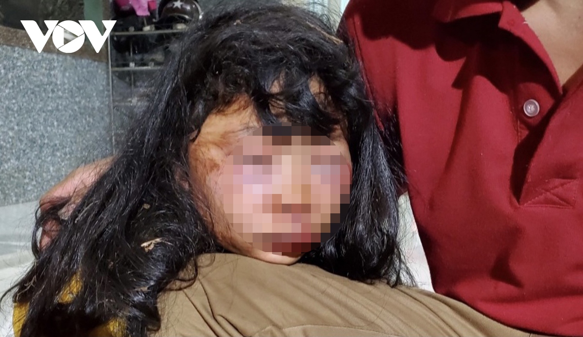 Điều tra vụ nữ sinh lớp 6 bị đánh dã man trong lô cao su