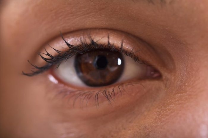 8 điều bạn có thể nhận biết qua gỉ mắt của bạn