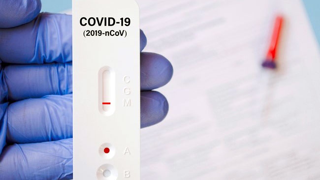 Tự ý mua dụng cụ test nhanh Covid-19 tiềm ẩn nhiều nguy cơ