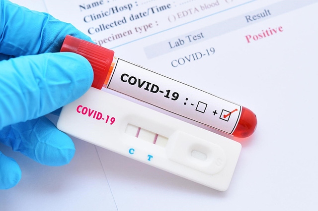 Bộ Y tế hướng dẫn xét nghiệm nhanh COVID-19 tại nhà