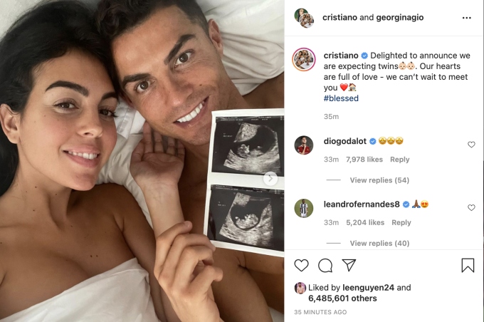 Bạn gái C.Ronaldo hạnh phúc thông báo đang mang thai đôi