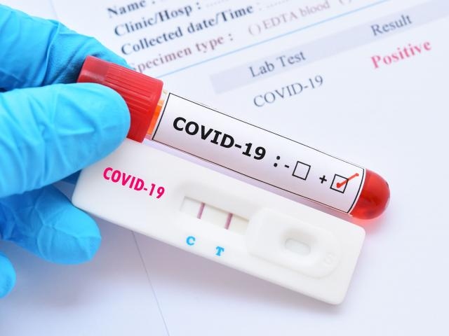 Tái nhiễm Covid-19 có nặng hơn?