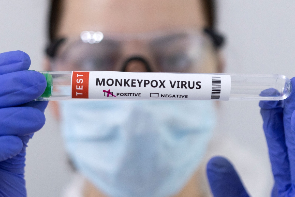 Các nước châu Âu liên tục xuất hiện các ca lây nhiễm đậu mùa khỉ đầu tiên