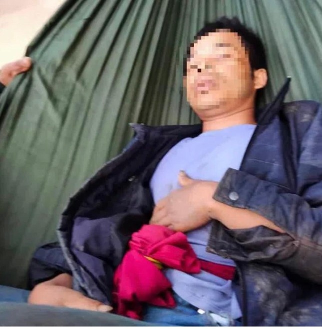 Nam thanh niên ở Quảng Trị bị trâu húc thủng bụng trong rừng sâu