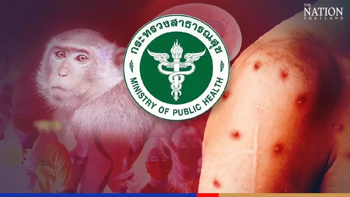 Thái Lan họp khẩn, nâng mức báo động quốc gia về bệnh đậu mùa khỉ