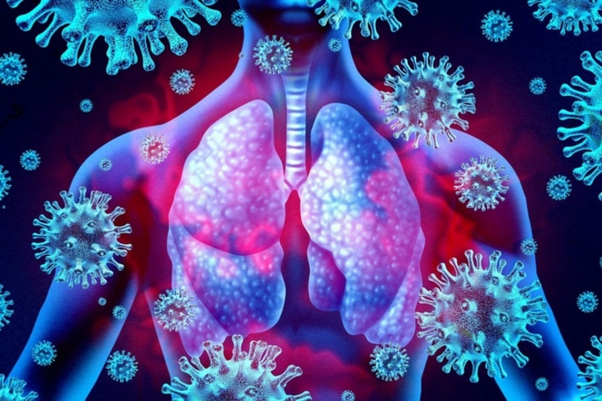Viêm phổi ở người cao tuổi - nguyên nhân và cách phòng bệnh