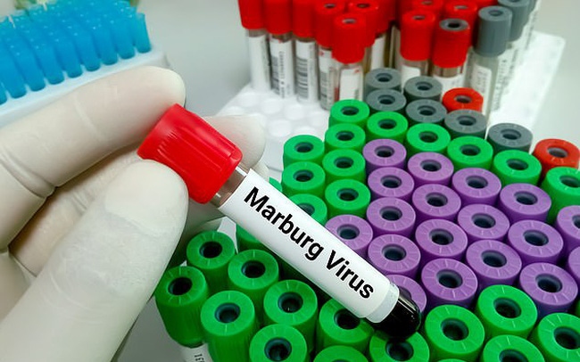 Cảnh giác cao với bệnh do virus Marburg