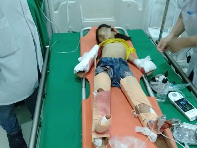 Vụ nổ lớn ở Nghệ An: 3 cháu bé đi xe đạp ngang qua gara ô tô bị hất văng xa