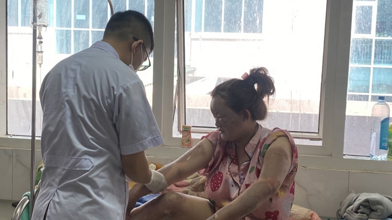 Tích cực điều trị cho 7 bệnh nhân bị bỏng do nổ bình gas mini ở Đắk Lắk