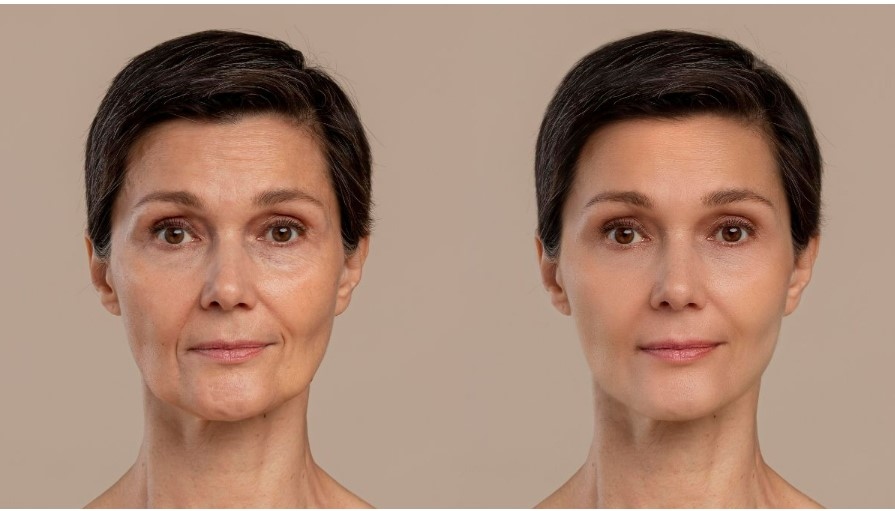 3 thành phần này có thể làm chậm quá trình lão hóa của da