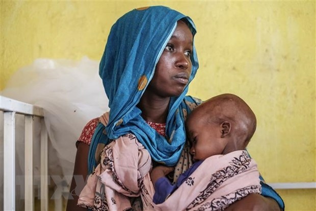 1,2 triệu trẻ em bị suy dinh dưỡng cấp tính ở Ethiopia