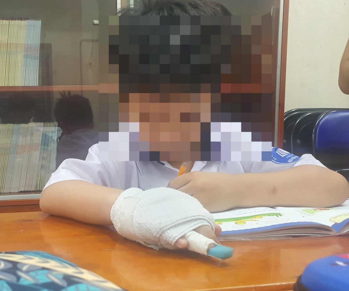 Xử lý nghiêm khắc cô giáo đánh gãy ngón tay học sinh