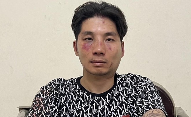 Nóng 24h: Cán bộ công an phường ở Hà Nội bị cướp đâm trọng thương