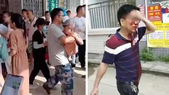 Tấn công bằng dao tại trường tiểu học Trung Quốc làm 39 người bị thương