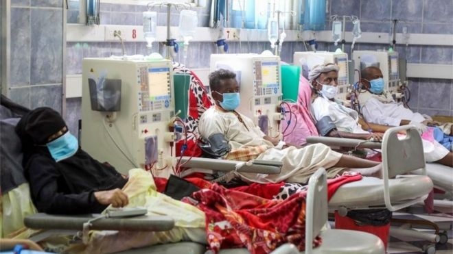 Số ca tử vong do Covid-19 ở Yemen chiếm 25% số ca mắc bệnh
