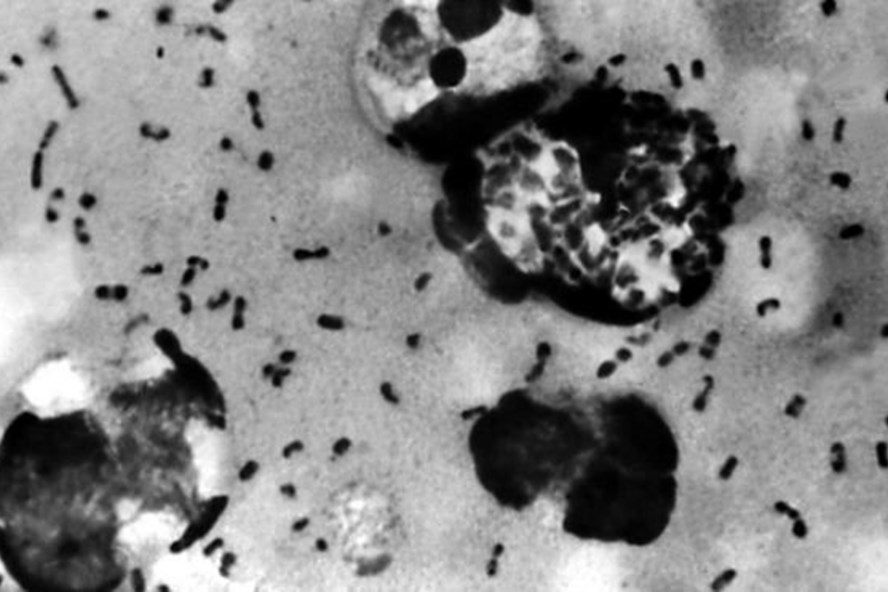 Trung Quốc phát hiện vi khuẩn dịch hạch tại 3 địa điểm ở Nội Mông Cổ