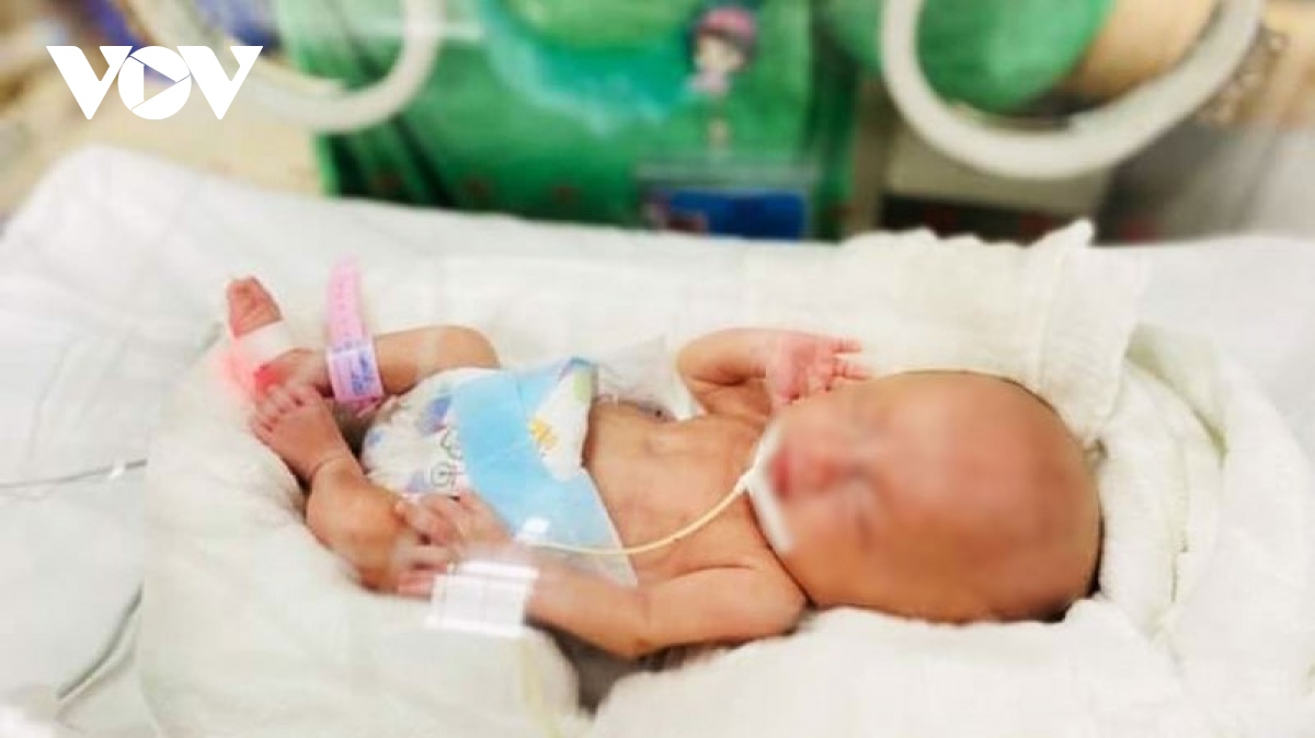 Kỳ tích mùa dịch của các y bác sỹ nuôi sống thành công em bé 400 gram